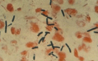 clostridium dogs colitis clostridium dogs colitis